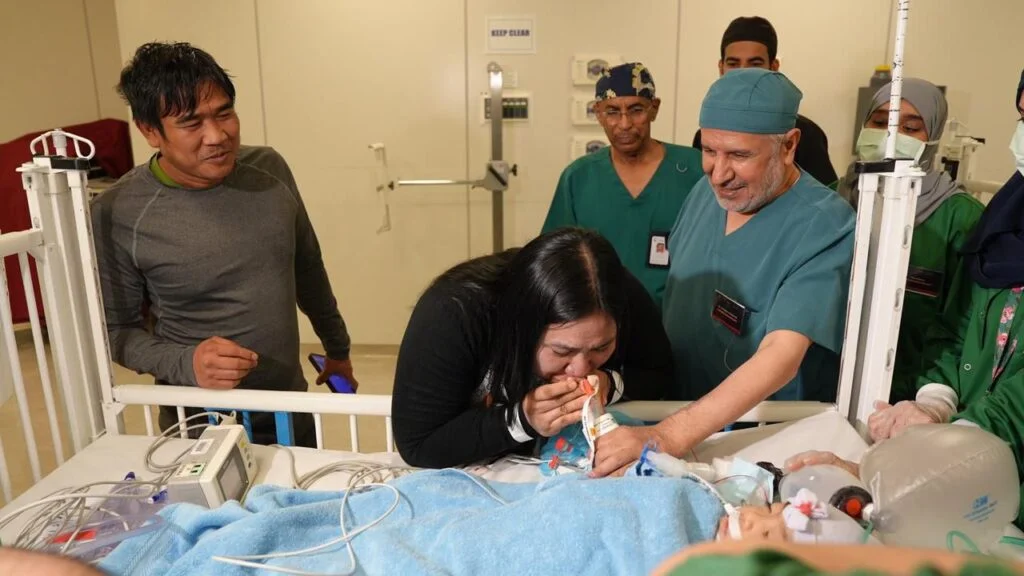 في إنجاز طبي جديد.. نجاح عملية فصل التوأم الملتصق الفلبيني (أوليفيا وجيانا) بعد 6 ساعات